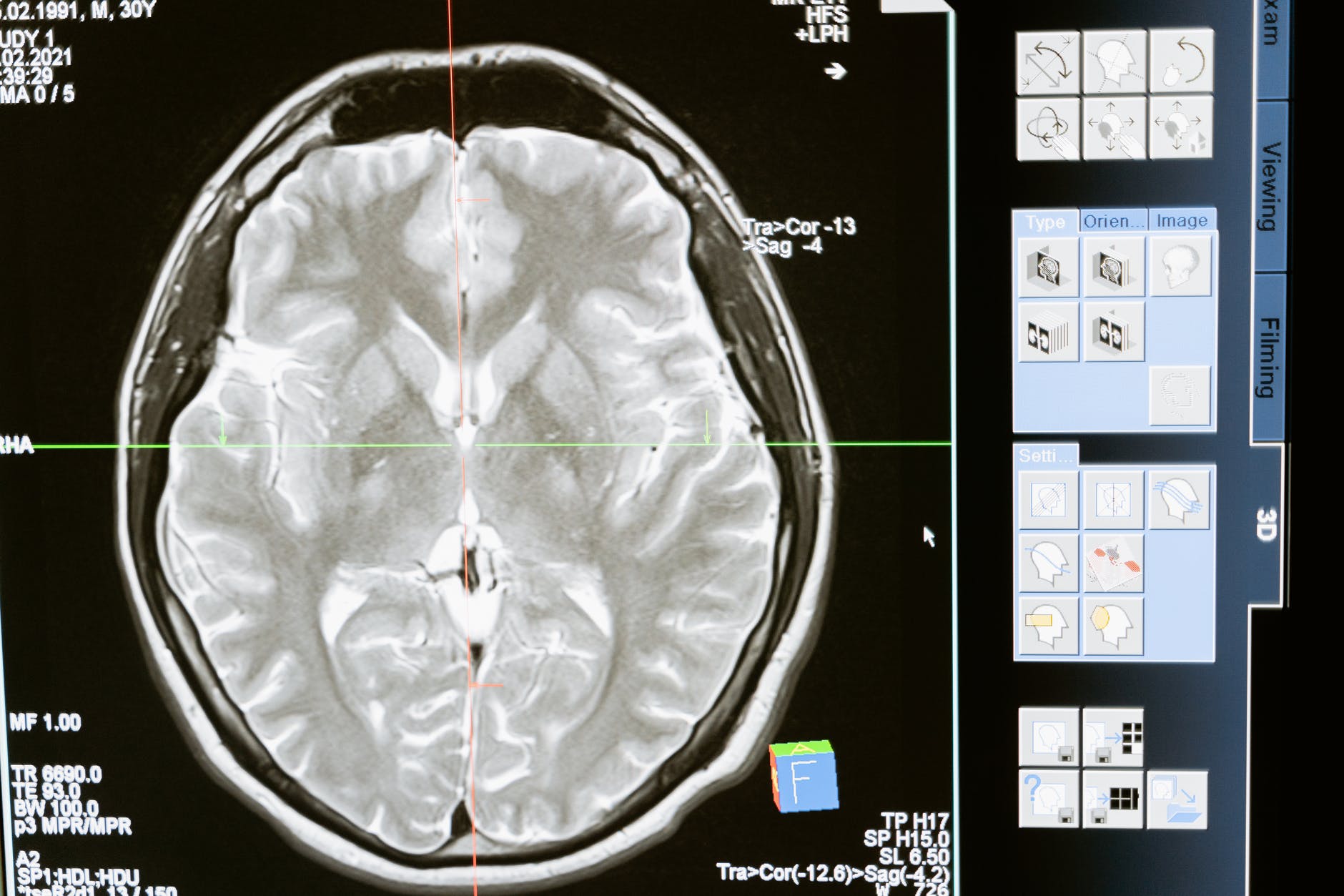xray image of a brain